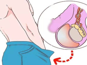 男性生殖器官长度测量标准：从哪里开始量才是正确的？详细解析与常见误区