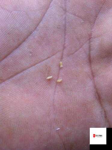 双腿间硬硬的胎头湿漉漉的挤出来的情况如何应对之详细探讨与方法