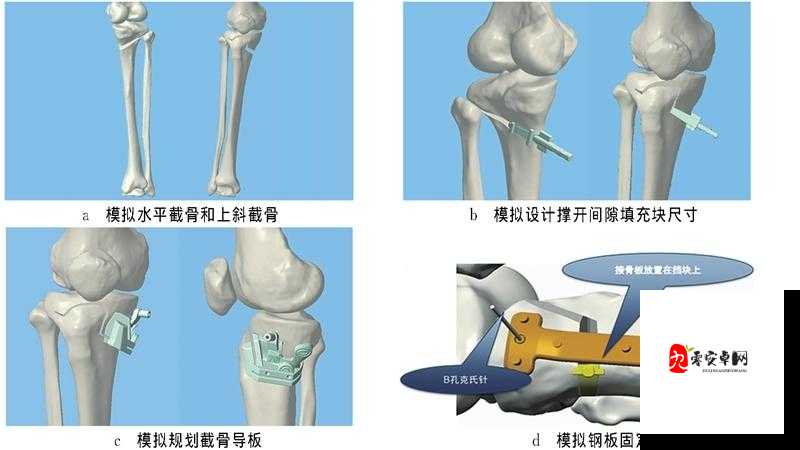 骨科 1v2h：骨科医生的挑战与成长之路