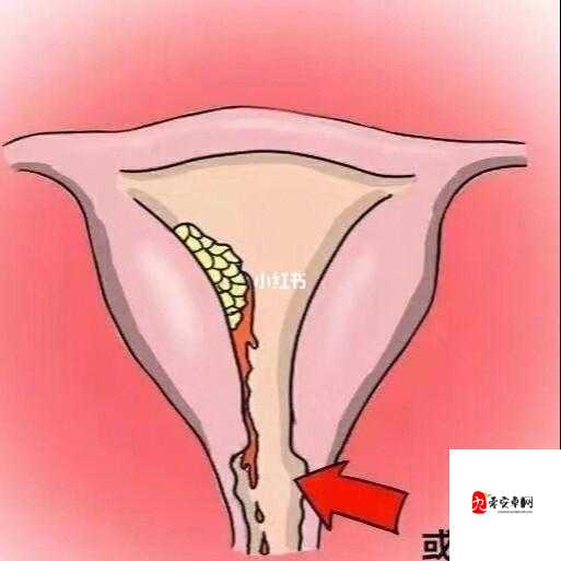 女生自己安慰后少量出血究竟是何原因