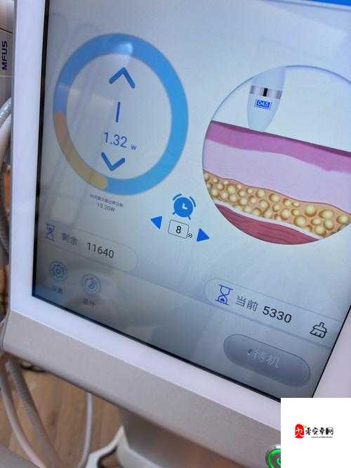 75 欧射频线和 65 欧射频线区别之详细对比分析及应用场景探讨