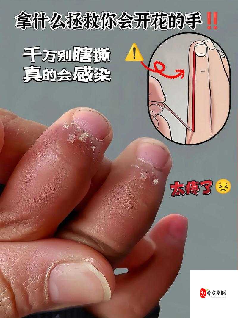 才一根手指头就喊疼是什么意思：是缺乏锻炼还是真的疼？