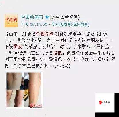 大学生进行口爆相关行为引发热议