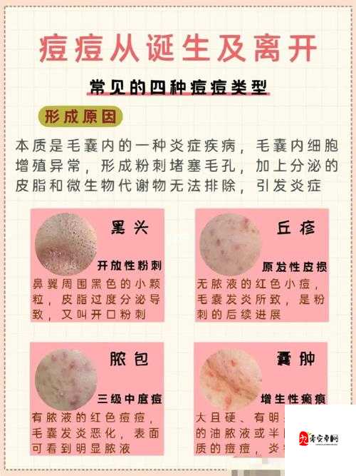 探究让小痘痘出现可令人浑身酥软的方法及相关奥秘