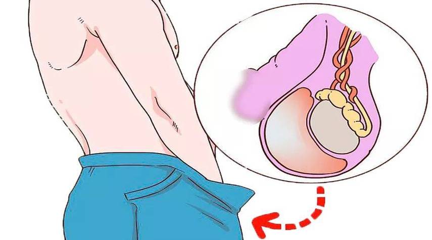 男性生殖器官长度测量标准：从哪里开始量才是正确的？详细解析与常见误区