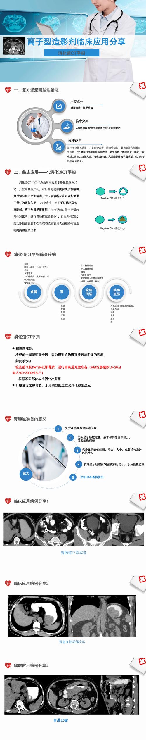 津影通 T 类是什么？它有哪些独特之处和重要作用？快来一探究竟